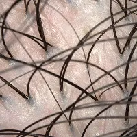 頭皮環境を健やかに